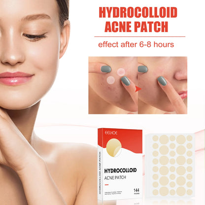 Invisible Face Acne Patches