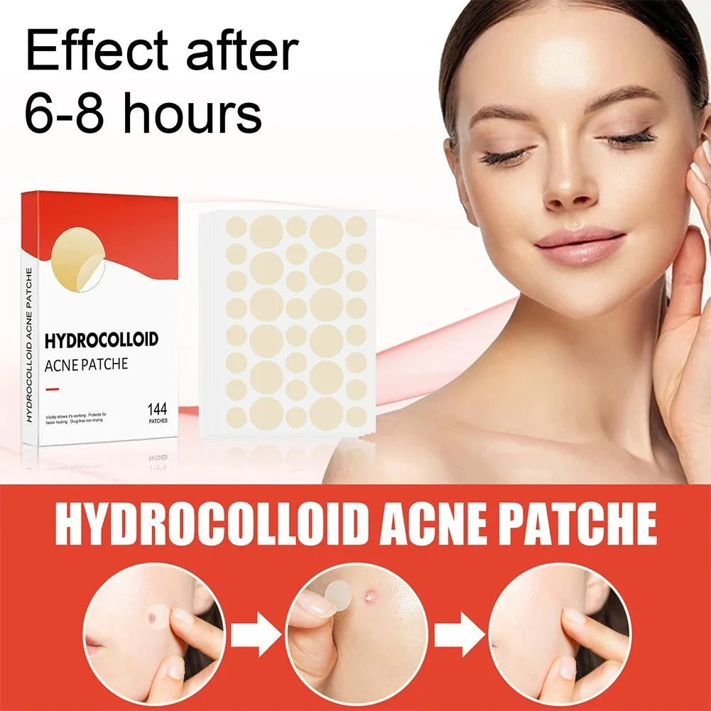 Invisible Face Acne Patches