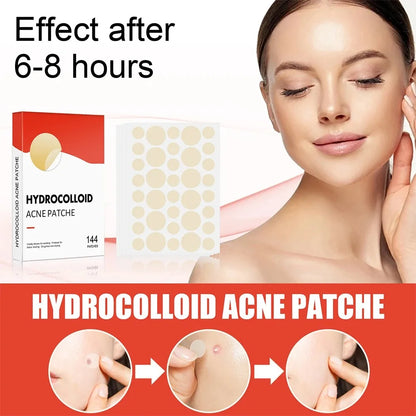 Invisible Face Acne Patches