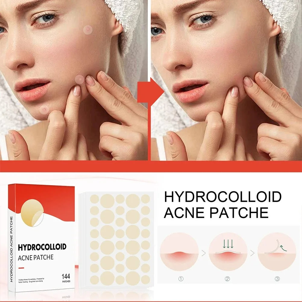 Invisible Face Acne Patches