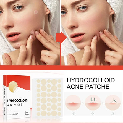 Invisible Face Acne Patches