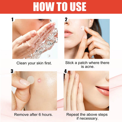 Invisible Face Acne Patches