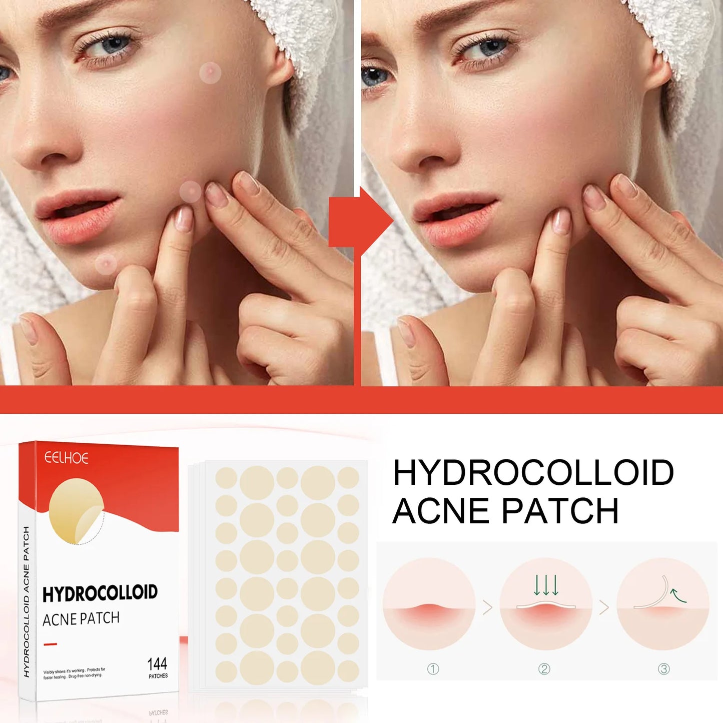Invisible Face Acne Patches